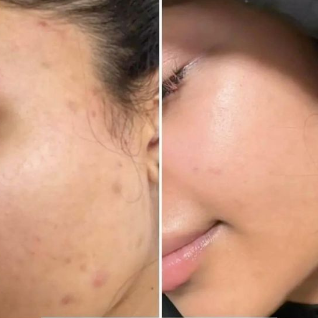 Glow Bar Ayanat – Curcuma, Citron & Acide kojique