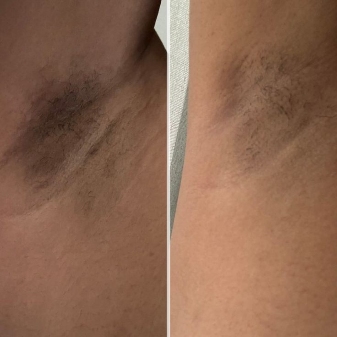 Glow Bar Ayanat – Curcuma, Citron & Acide kojique