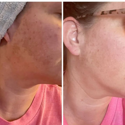 Glow Bar Ayanat – Curcuma, Citron & Acide kojique
