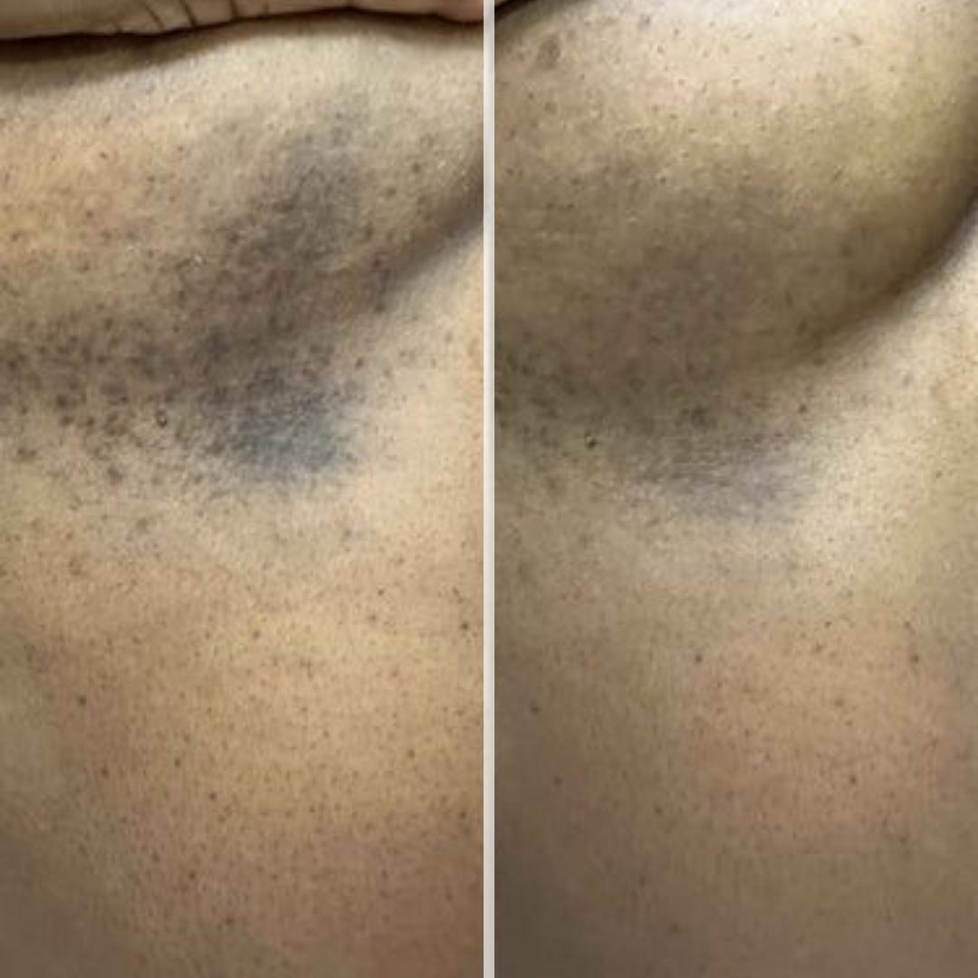 Glow Bar Ayanat – Curcuma, Citron & Acide kojique